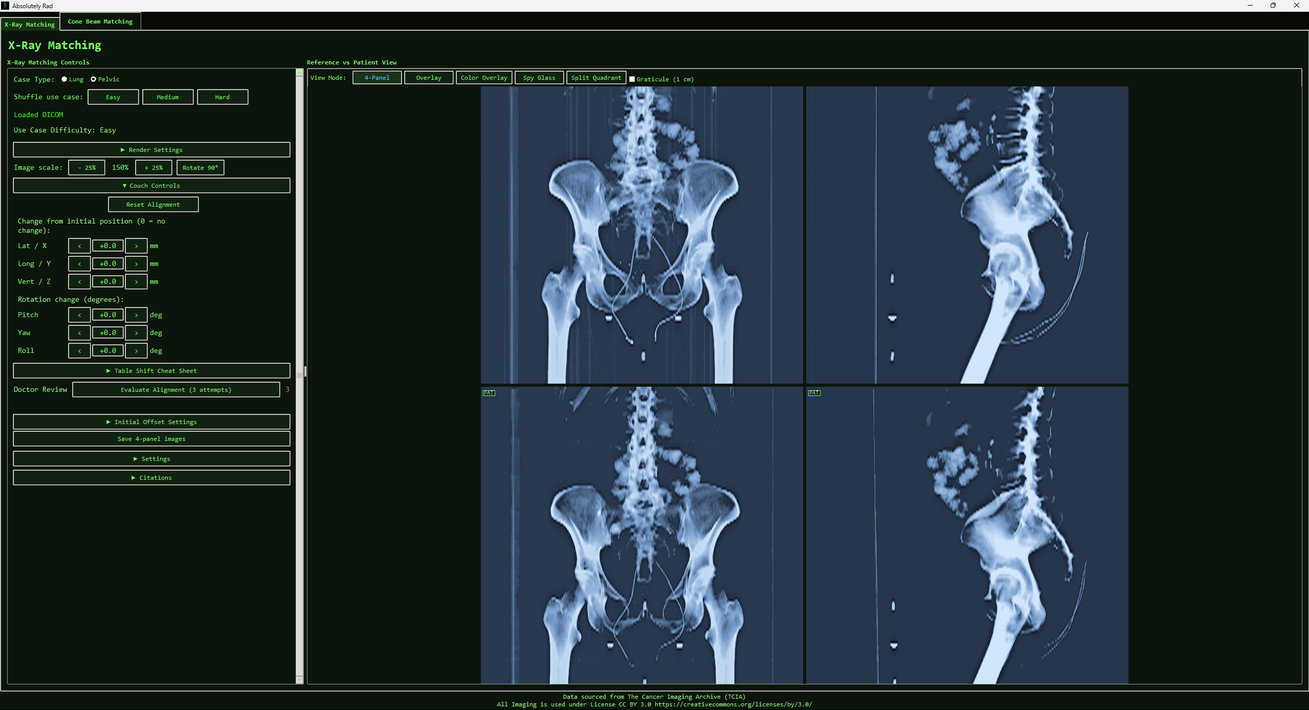 X-ray view mode interface
