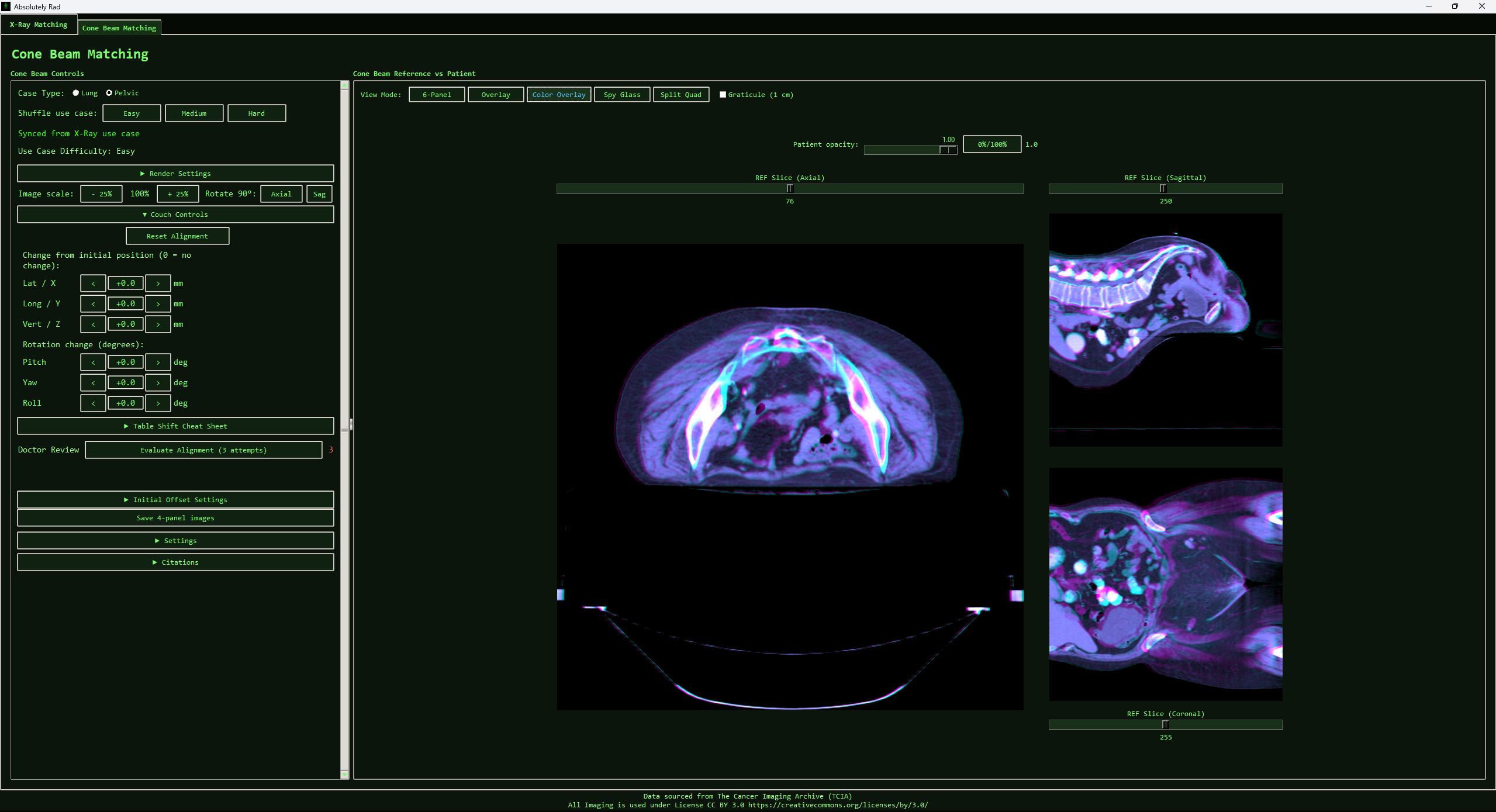 Cone beam CT view mode interface
