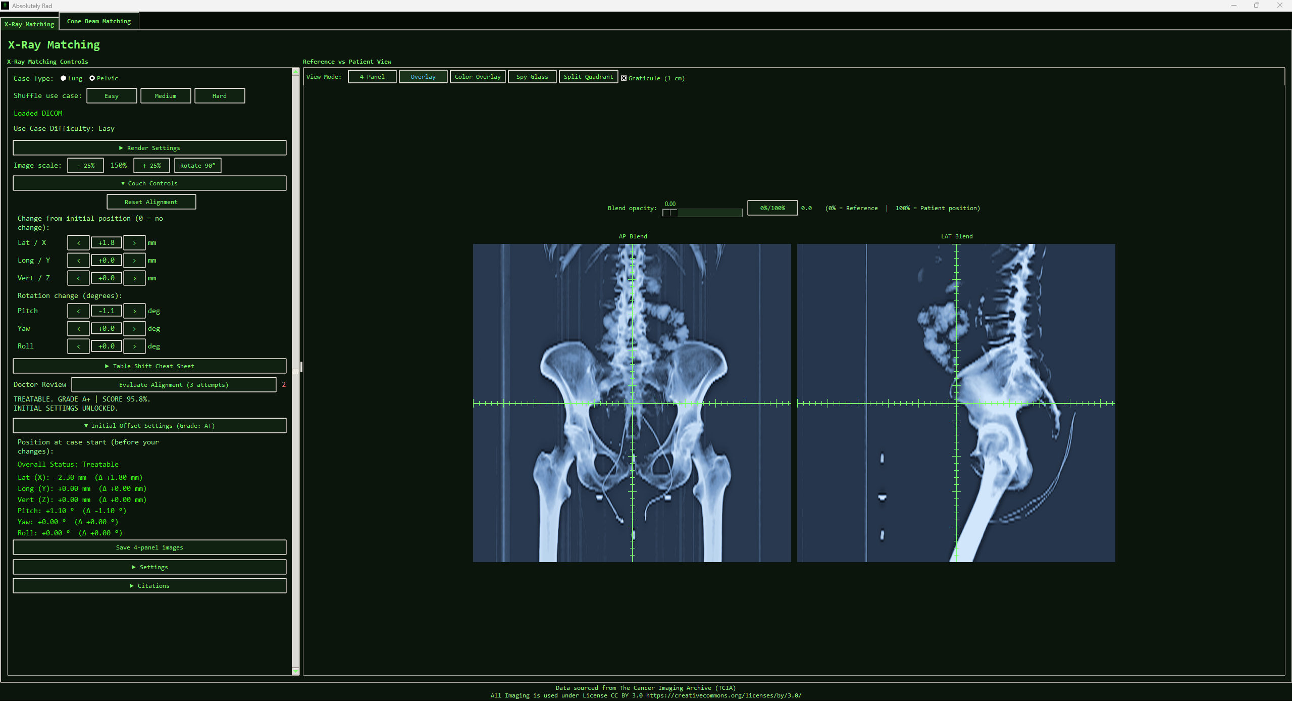 Gamified alignment scoring interface